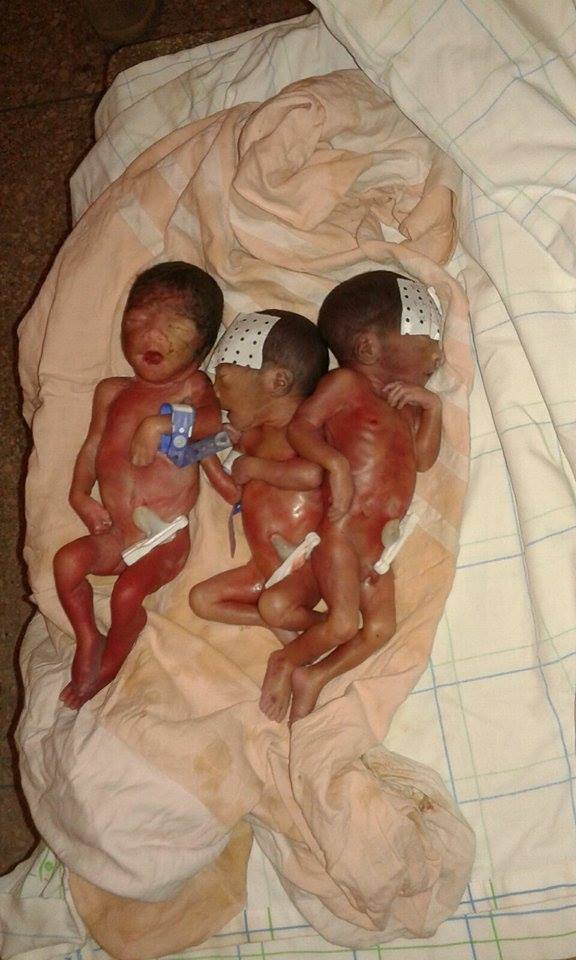 مجزرة الأطفال الخدج بزاكورة تستمر بوفاة أربعة توائم لسيدة من تازارين (3)