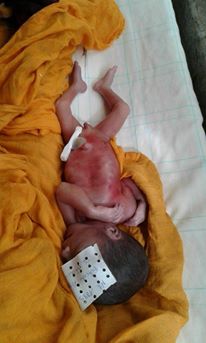 مجزرة الأطفال الخدج بزاكورة تستمر بوفاة أربعة توائم لسيدة من تازارين (6)